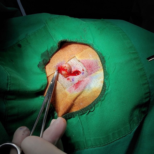 15cf5d2e8fa1595d73fceffb64fbcdc4_1786414040_1625.jpg